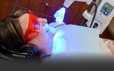Teeth Whitening